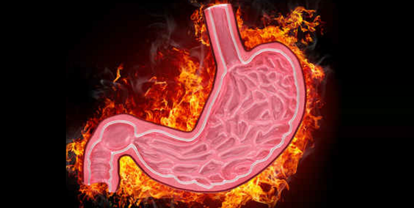 Mide Yanması Nasıl Geçer ?